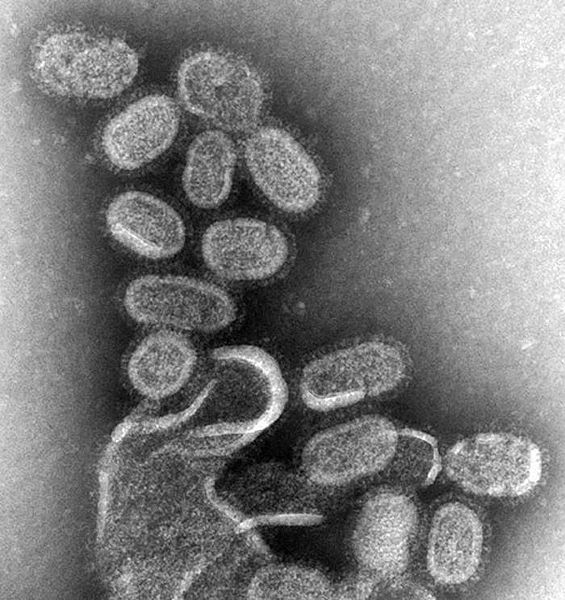 EM Of Influenza Virus (photo courtesy of CDC)