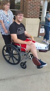 Ben Akers after his first amputation in 2015. (photo from Facebook)